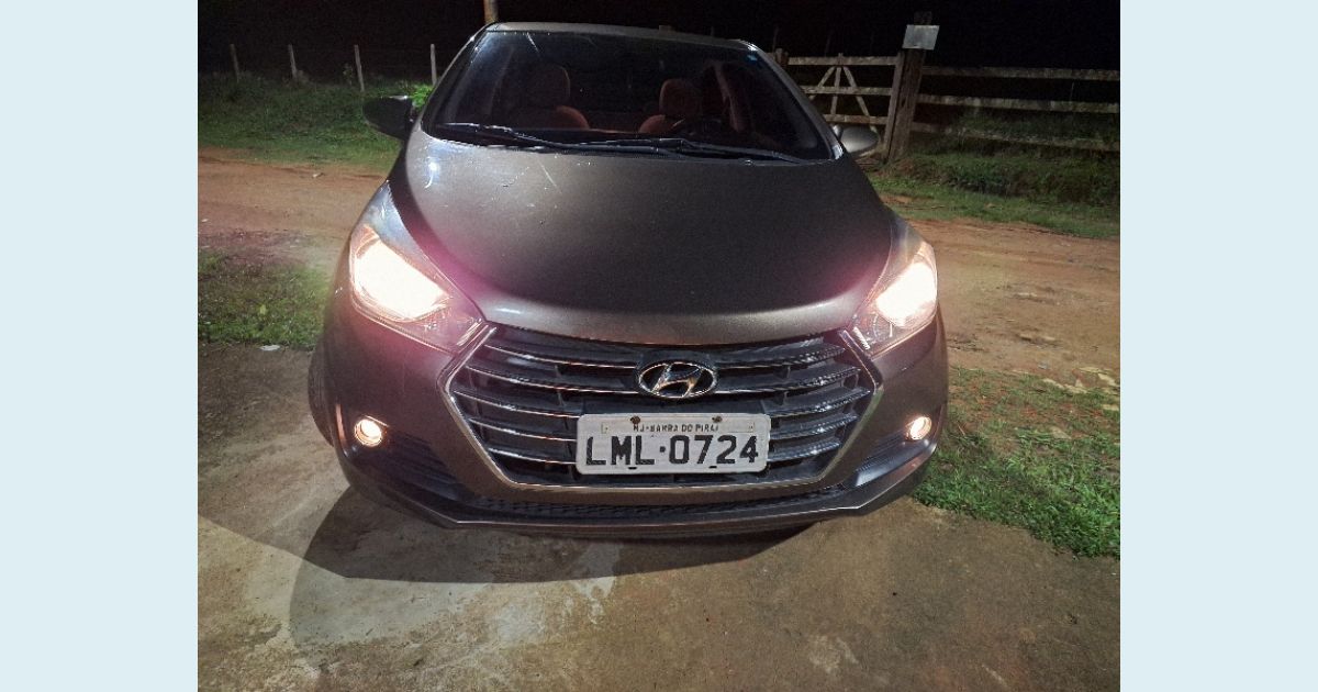 HYUNDAI HB20S